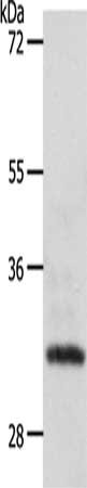 Gel: 10%SDS-PAGE, Lysate: 50 ug, Lane: Human fetal kidney tissue, Primary antibody: CSB-PA565061(SLC2A4RG Antibody) at dilution 1/250, Secondary antibody: Goat anti rabbit IgG at 1/8000 dilution, Exposure time: 1 hour