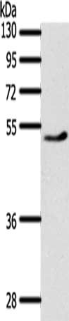 Gel: 10%SDS-PAGE, Lysate: 40 ug, Lane: Mouse heart tissue, Primary antibody: CSB-PA565092(PPARD Antibody) at dilution 1/500, Secondary antibody: Goat anti rabbit IgG at 1/8000 dilution, Exposure time: 30 seconds