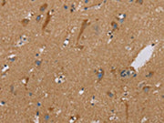 The image on the left is immunohistochemistry of paraffin-embedded Human brain tissue using CSB-PA565844(PUS10 Antibody) at dilution 1/40, on the right is treated with synthetic peptide. (Original magnification: ×200)