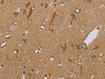 The image on the left is immunohistochemistry of paraffin-embedded Human brain tissue using CSB-PA565844(PUS10 Antibody) at dilution 1/40, on the right is treated with synthetic peptide. (Original magnification: ×200)