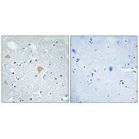 Immunohistochemistry analysis of paraffin-embedded human brain tissue using CTRO antibody.