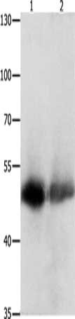 Gel: 10%SDS-PAGE, Lysate: 60 ug, Lane 1-2: Human bladder carcinoma tissue, Human liver cancer tissue, Primary antibody: CSB-PA566314(CEACAM1 Antibody) at dilution 1/300, Secondary antibody: Goat anti rabbit IgG at 1/8000 dilution, Exposure time: 3...
