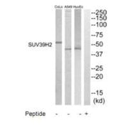 Western blot analysis of extracts from HuvEC, A549 and COLO205 cells, using SUV39H2 antibody.