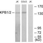 Western blot analysis of extracts from Jurkat cells and COLO205 cells, using KPB1/2 antibody.