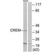 Western blot analysis of extracts from K562 cells, using CREM antibody.