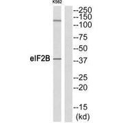 Western blot analysis of extracts from K562 cells, using eIF2B (Ab-67) antibody.