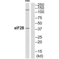 Western blot analysis of extracts from K562 cells, using eIF2B (Ab-67) antibody.