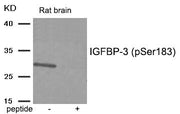 Western blot analysis of extracts from Rat brain tissue using IGFBP-3 (Phospho-Ser183) antibody.The lane on the right is treated with the antigen-specific peptide.