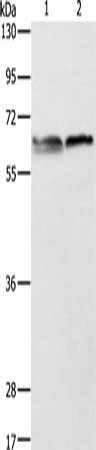 Gel: 10%SDS-PAGE, Lysate: 40 ug, Lane 1-2: 293T cells, Jurkat cells, Primary antibody: CSB-PA567068(ALAS2 Antibody) at dilution 1/1000, Secondary antibody: Goat anti rabbit IgG at 1/8000 dilution, Exposure time: 1 minute