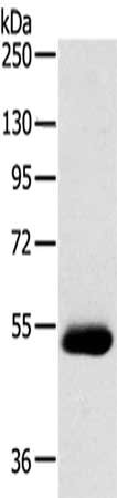 Gel: 8%SDS-PAGE,Lysate: 40 ug,,Primary antibody: CSB-PA567724(SERINC4 Antibody) at dilution 1/200 dilution,Secondary antibody: Goat anti rabbit IgG at 1/8000 dilution,Exposure time: 5 minutes