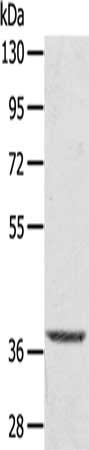 Gel: 8%SDS-PAGE, Lysate: 40 ug, Lane: Hepg2 cells, Primary antibody: CSB-PA567895(TBC1D21 Antibody) at dilution 1/300, Secondary antibody: Goat anti rabbit IgG at 1/8000 dilution, Exposure time: 10 seconds
