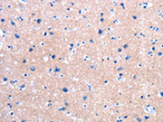 The image on the left is immunohistochemistry of paraffin-embedded Human brain tissue using CSB-PA568435(FPR2 Antibody) at dilution 1/25, on the right is treated with synthetic peptide. (Original magnification: ×200)