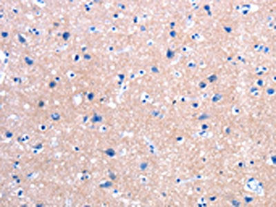 The image on the left is immunohistochemistry of paraffin-embedded Human brain tissue using CSB-PA568435(FPR2 Antibody) at dilution 1/25, on the right is treated with synthetic peptide. (Original magnification: ×200)