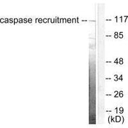Western blot analysis of extracts from HeLa cells, using CARD6 antibody.