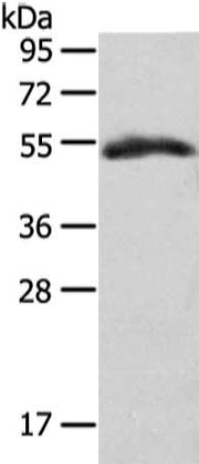 Gel: 8%SDS-PAGE, Lysate: 40 ug, Lane: Human placenta tissue, Primary antibody: CSB-PA569411(GLRA1 Antibody) at dilution 1/350 dilution, Secondary antibody: Goat anti rabbit IgG at 1/8000 dilution, Exposure time: 2 minutes