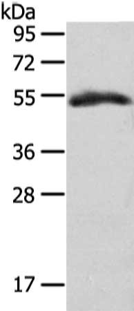 Gel: 8%SDS-PAGE, Lysate: 40 ug, Lane: Human placenta tissue, Primary antibody: CSB-PA569411(GLRA1 Antibody) at dilution 1/350 dilution, Secondary antibody: Goat anti rabbit IgG at 1/8000 dilution, Exposure time: 2 minutes