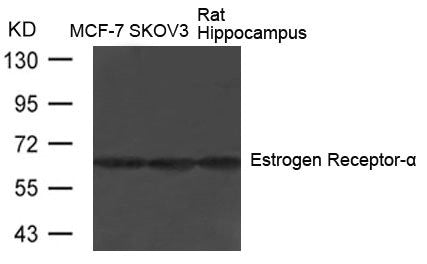 Western blot analysis of extracts from MCF-7