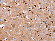 The image on the left is immunohistochemistry of paraffin-embedded Human brain tissue using CSB-PA569512(GCGR Antibody) at dilution 1/25, on the right is treated with synthetic peptide. (Original magnification: ×200)