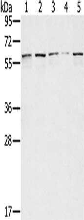 Gel: 8%SDS-PAGE, Lysate: 40 ug, Lane 1-5: Lovo cells, hela cells, K562 cells, Raji cells, hepg2 cells, Primary antibody: CSB-PA569570(SESN1 Antibody) at dilution 1/200, Secondary antibody: Goat anti rabbit IgG at 1/8000 dilution, Exposure time: 40...