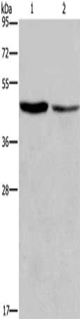 Gel: 10%SDS-PAGE, Lysate: 40 ug, Lane 1-2: Raji cells, LoVo cells, Primary antibody: CSB-PA569618(CFLAR Antibody) at dilution 1/200, Secondary antibody: Goat anti rabbit IgG at 1/8000 dilution, Exposure time: 2 minutes
