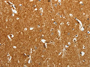 The image on the left is immunohistochemistry of paraffin-embedded Human brain tissue using CSB-PA569832(TMSB10 Antibody) at dilution 1/25, on the right is treated with synthetic peptide. (Original magnification: ×200)