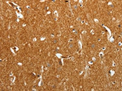The image on the left is immunohistochemistry of paraffin-embedded Human brain tissue using CSB-PA569832(TMSB10 Antibody) at dilution 1/25, on the right is treated with synthetic peptide. (Original magnification: ×200)