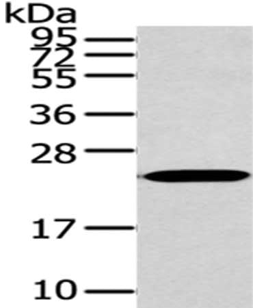 Gel: 12%SDS-PAGE,Lysate: 40 ug,,Primary antibody: CSB-PA569844(ARL2 Antibody) at dilution 1/200 dilution,Secondary antibody: Goat anti rabbit IgG at 1/8000 dilution,Exposure time: 10 seconds