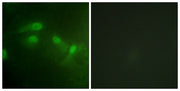 Immunofluorescence staining of methanol-fixed HeLa cells using MDM2 (Phospho-Ser186/Ser188) Antibody.