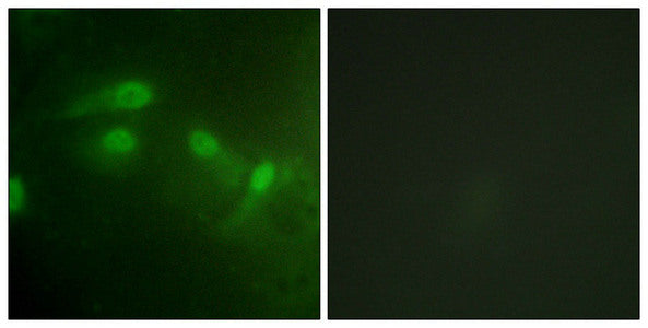 Immunofluorescence staining of methanol-fixed HeLa cells using MDM2 (Phospho-Ser186/Ser188) Antibody.