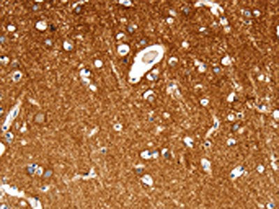 The image on the left is immunohistochemistry of paraffin-embedded Human brain tissue using CSB-PA570132(MAP4K1 Antibody) at dilution 1/30, on the right is treated with synthetic peptide. (Original magnification: ×200)