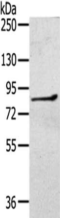 Gel: 6%SDS-PAGE,Lysate: 40 ug,,Primary antibody: CSB-PA570302(RASA2 Antibody) at dilution 1/400 dilution,Secondary antibody: Goat anti rabbit IgG at 1/8000 dilution,Exposure time: 3 minutes