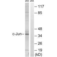 Western blot analysis of extracts from 293 cells, using c-Jun (Ab-63) antibody.