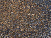 The image on the left is immunohistochemistry of paraffin-embedded Human tonsil tissue using CSB-PA570795(IRF9 Antibody) at dilution 1/50, on the right is treated with fusion protein. (Original magnification: ×200)
