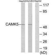 Western blot analysis of extracts from HepG2 cells and HUVEC cells, using CAMK5 antibody.
