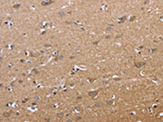 The image on the left is immunohistochemistry of paraffin-embedded Human brain tissue using CSB-PA571087(ECE1 Antibody) at dilution 1/50, on the right is treated with fusion protein. (Original magnification: ×200)