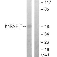 Western blot analysis of extracts from HepG2 cells, using hnRNP F antibody.