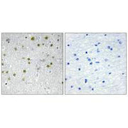 Immunohistochemistry analysis of paraffin-embedded human brain tissue, using NRIP2 antibody.