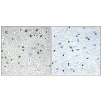 Immunohistochemistry analysis of paraffin-embedded human brain tissue, using NRIP2 antibody.