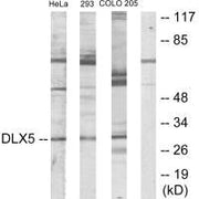 Western blot analysis of extracts from HeLa cells, 293 cells and COLO205 cells, using DLX5 antibody.