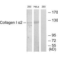Western blot analysis of extracts from 293 cells and HeLa cells, using Collagen I α2 antibody.