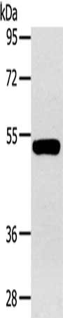 Gel: 8%SDS-PAGE, Lysate: 40 ug, Lane: Human fetal muscle tissue, Primary antibody: CSB-PA571821(GJA9 Antibody) at dilution 1/400, Secondary antibody: Goat anti rabbit IgG at 1/8000 dilution, Exposure time: 1 minute