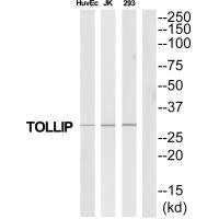 Western blot analysis of extracts from HuvEc/Jurkat/293 cells, using TOLLIP antibody.