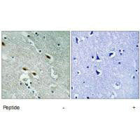 Immunohistochemistry analysis of paraffin-embedded human brain tissue using 53BP1 antibody.