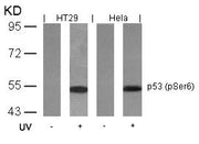 Western blot analysis of extracts from HT29 and Hela cells untreated or treated with UV using p53(Phospho-Ser6) Antibody.