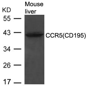 Western blot analysis of extracts from Mouse liver tissue using CCR5(CD195) Antibody.