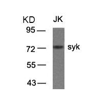 Western blot analysis of extracts from JK cells using syk(Ab-323) Antibody.