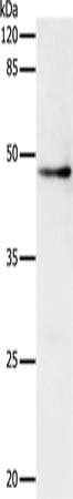 Gel: 10%SDS-PAGE, Lysate: 30 ug, Lane: Hela cells, Primary antibody: CSB-PA572992(DRD1 Antibody) at dilution 1/500, Secondary antibody: Goat anti rabbit IgG at 1/8000 dilution, Exposure time: 10 seconds