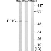 Western blot analysis of extracts from HepG2 cells and HUVEC cells, using EEF1G antibody.