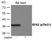 Western blot analysis of extracts from Rat heart using RFA2 (Phospho-Thr21) Antibody.The lane on the right is treated with the antigen-specific peptide.