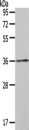 Gel: 8%SDS-PAGE,Lysate: 40 ug,,Primary antibody: CSB-PA573488(HOXA11 Antibody) at dilution 1/125 dilution,Secondary antibody: Goat anti rabbit IgG at 1/8000 dilution,Exposure time: 2 minutes